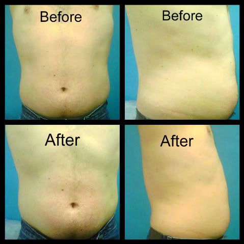 liz skincare miami 33135